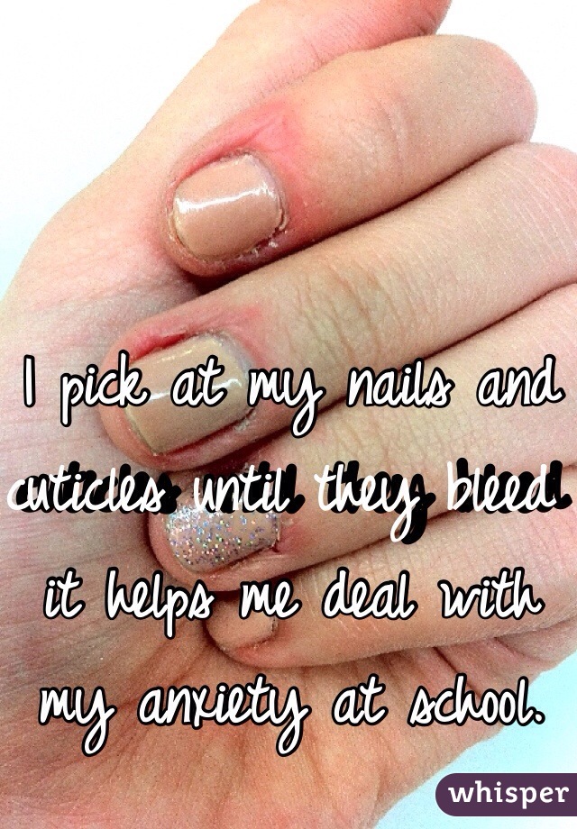 I pick at my nails and cuticles until they bleed it helps me deal with my anxiety at school.