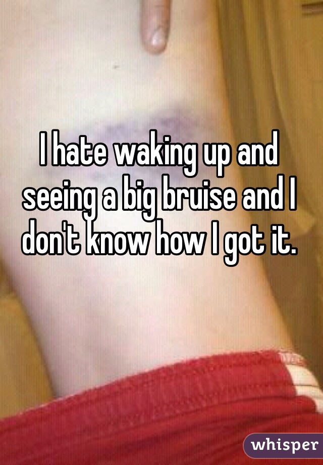 I hate waking up and seeing a big bruise and I don't know how I got it.
