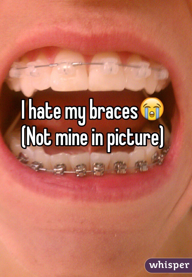 I hate my braces😭
(Not mine in picture)