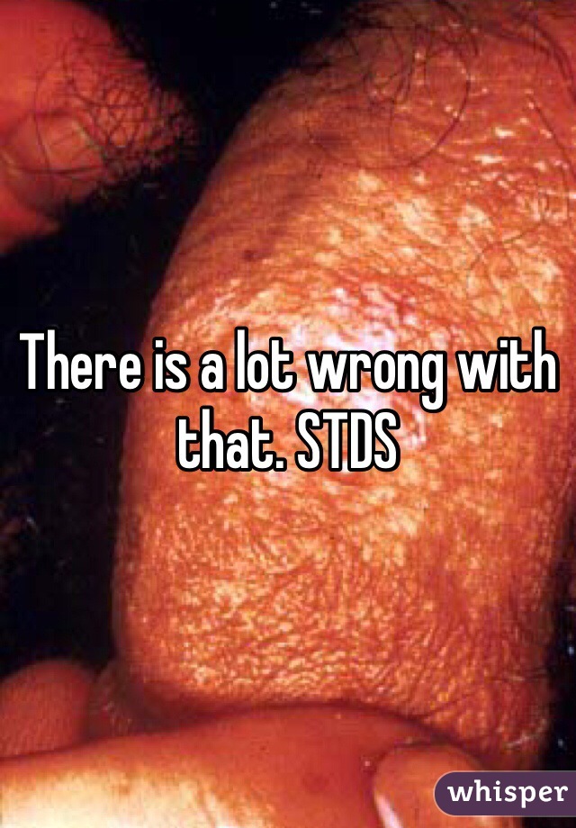 There is a lot wrong with that. STDS