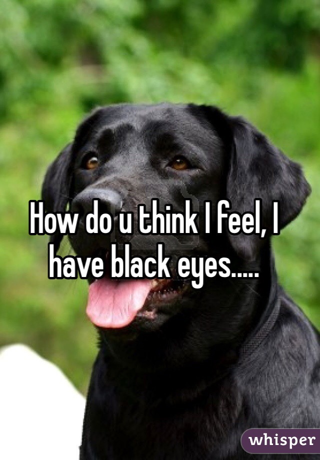 How do u think I feel, I have black eyes.....