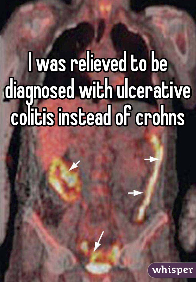 I was relieved to be diagnosed with ulcerative colitis instead of crohns