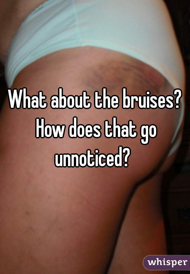What about the bruises? How does that go unnoticed?  