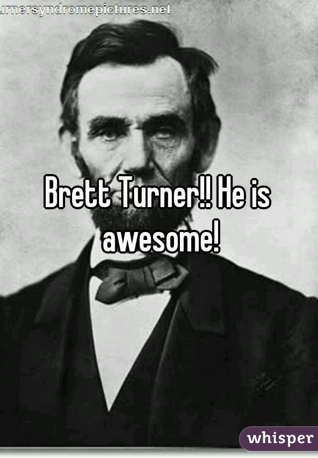 Brett Turner!! He is awesome!