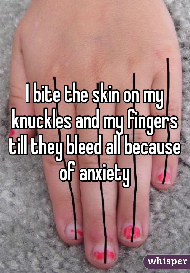 I bite the skin on my knuckles and my fingers till they bleed all because of anxiety 