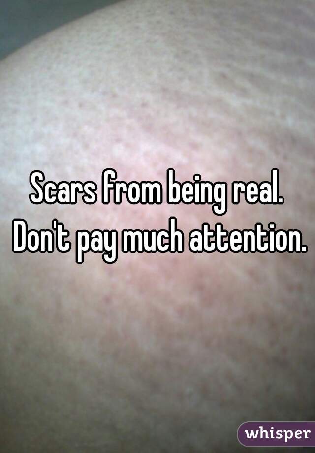 Scars from being real. Don't pay much attention.