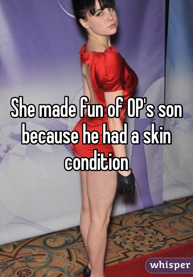 She made fun of OP's son because he had a skin condition 