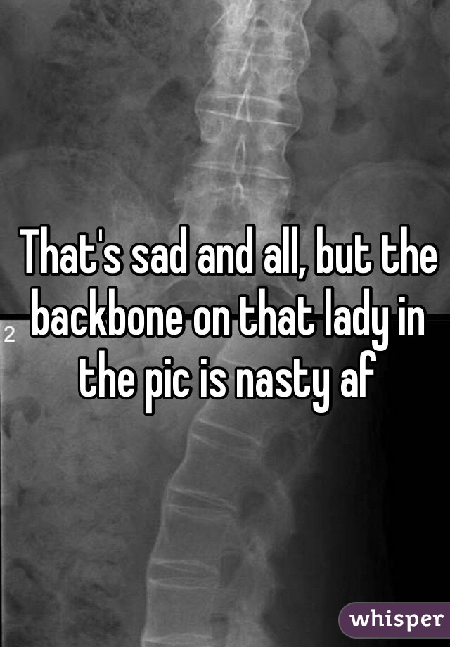 That's sad and all, but the backbone on that lady in the pic is nasty af