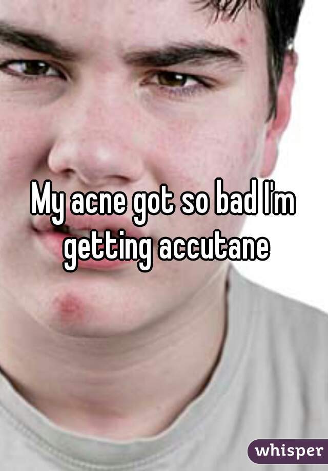 My acne got so bad I'm getting accutane