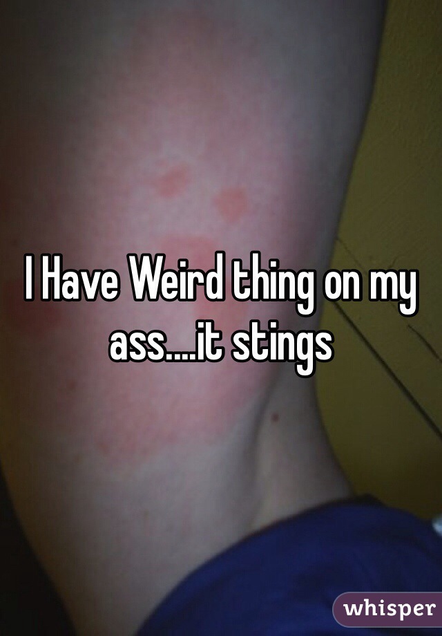 I Have Weird thing on my ass....it stings