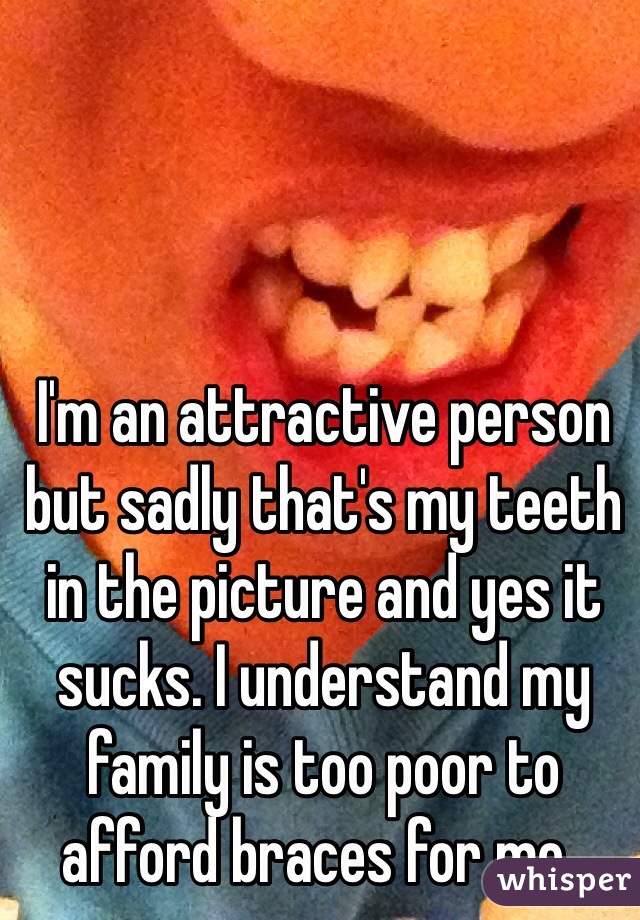 I'm an attractive person but sadly that's my teeth in the picture and yes it sucks. I understand my family is too poor to afford braces for me.. 