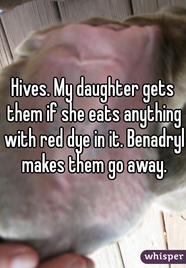 Hives. My daughter gets them if she eats anything with red dye in it. Benadryl makes them go away.