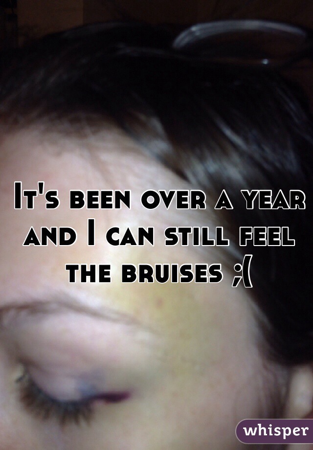 It's been over a year and I can still feel the bruises ;(
