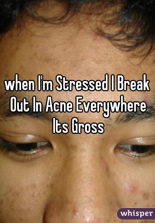 when I'm Stressed I Break Out In Acne Everywhere Its Gross