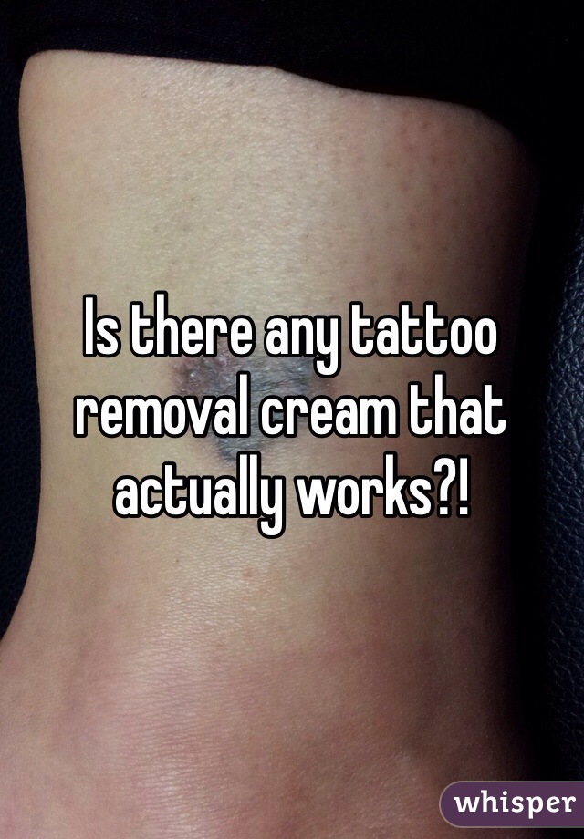 Is there any tattoo removal cream that actually works?!