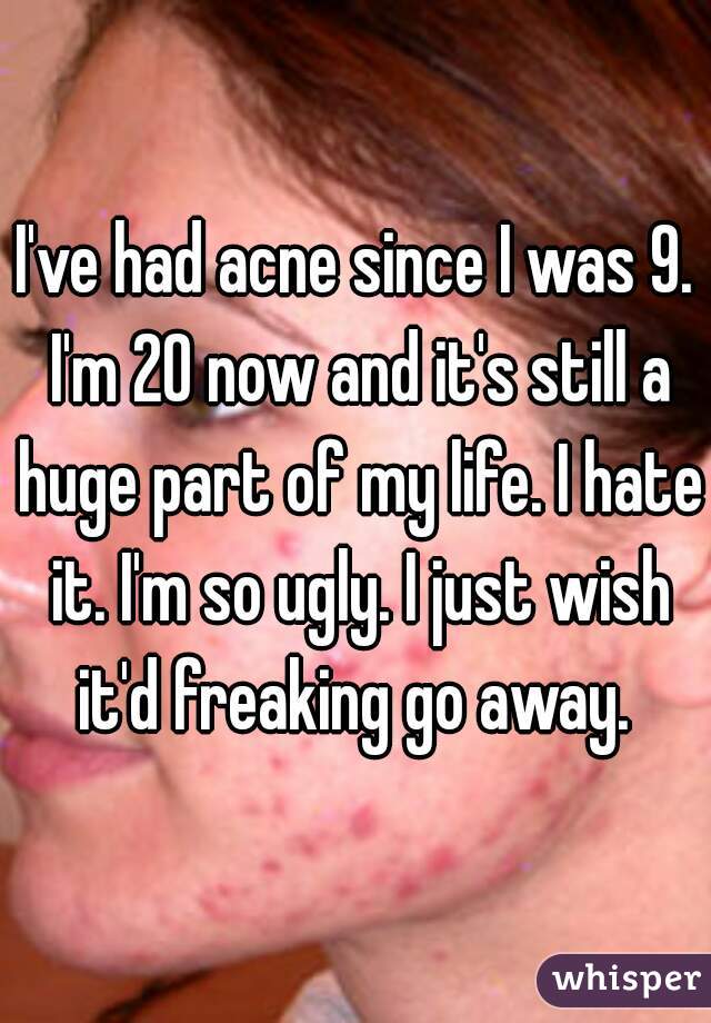 I've had acne since I was 9. I'm 20 now and it's still a huge part of my life. I hate it. I'm so ugly. I just wish it'd freaking go away. 