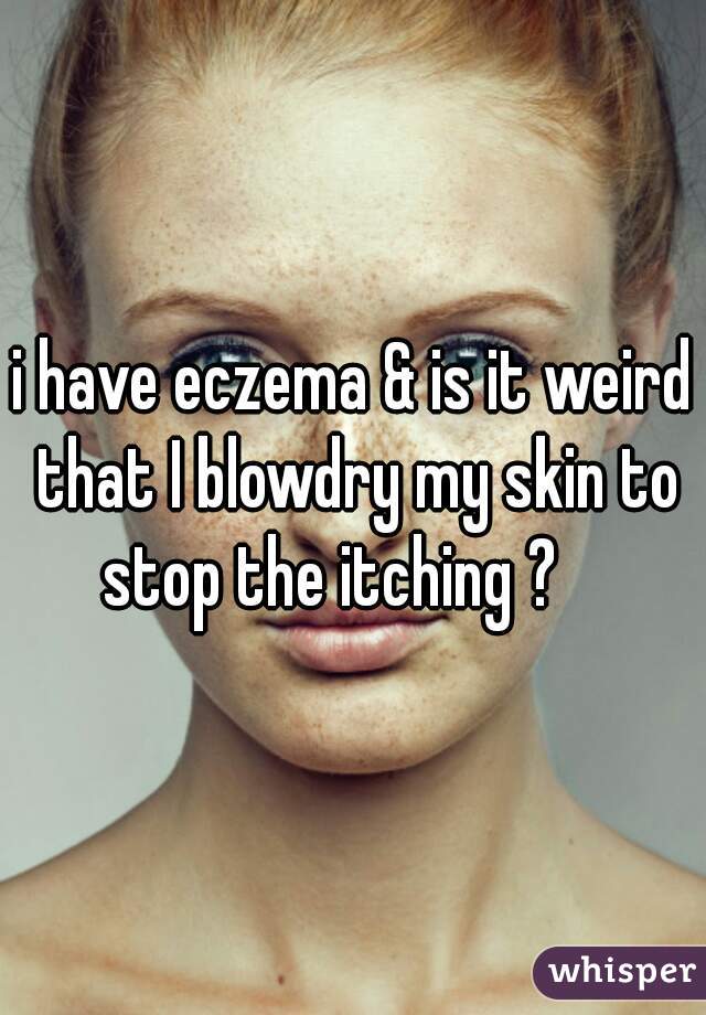 i have eczema & is it weird that I blowdry my skin to stop the itching ?    