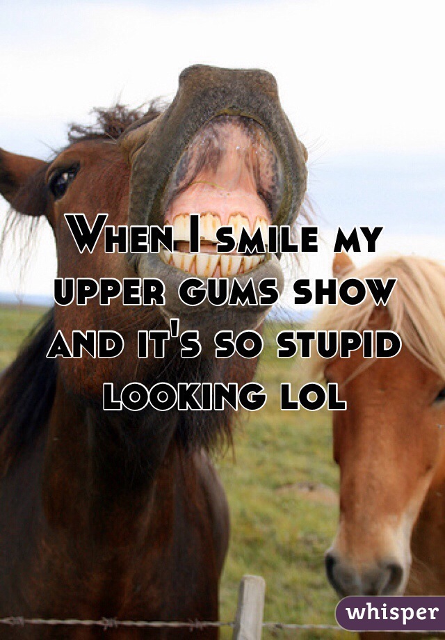 When I smile my upper gums show and it's so stupid looking lol 