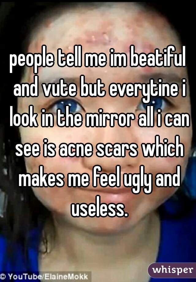 people tell me im beatiful and vute but everytine i look in the mirror all i can see is acne scars which makes me feel ugly and useless.