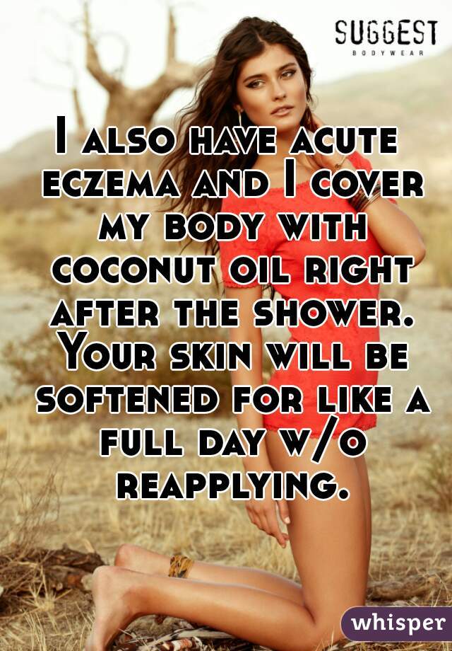 I also have acute eczema and I cover my body with coconut oil right after the shower. Your skin will be softened for like a full day w/o reapplying.