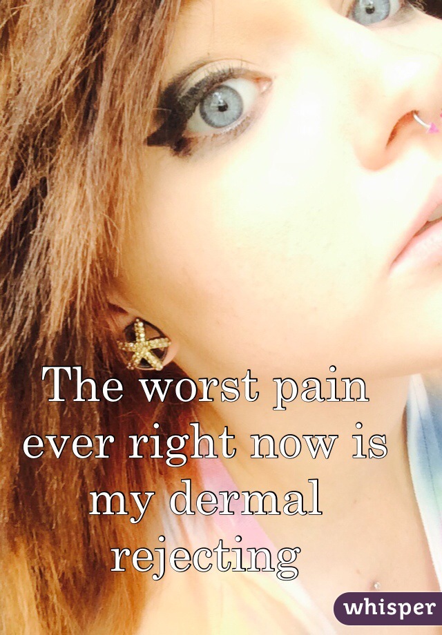 The worst pain ever right now is my dermal rejecting 
