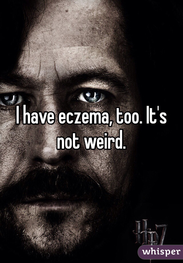 I have eczema, too. It's not weird. 