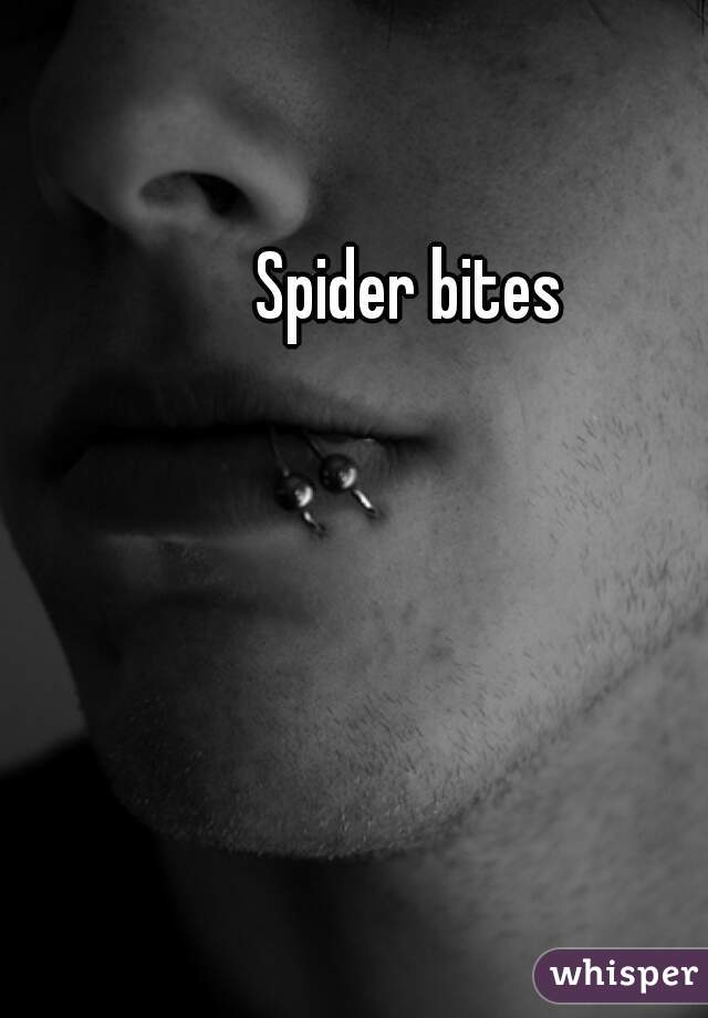 Spider bites 