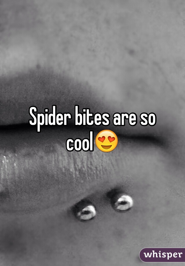 Spider bites are so cool😍