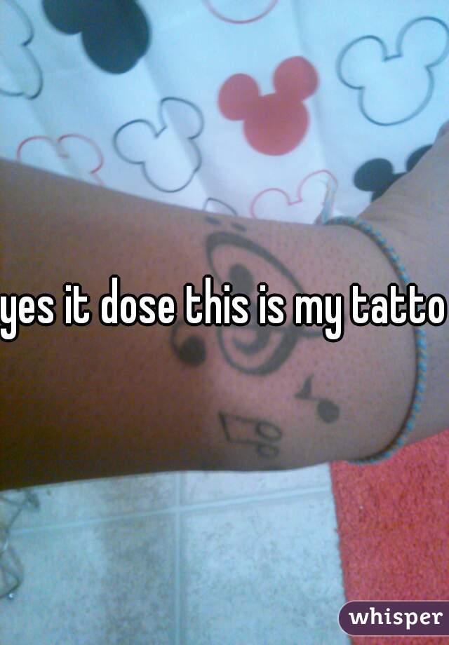 yes it dose this is my tattoo