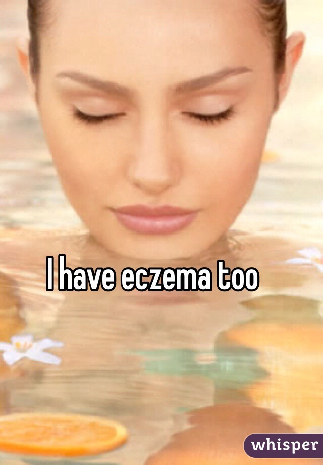 I have eczema too
