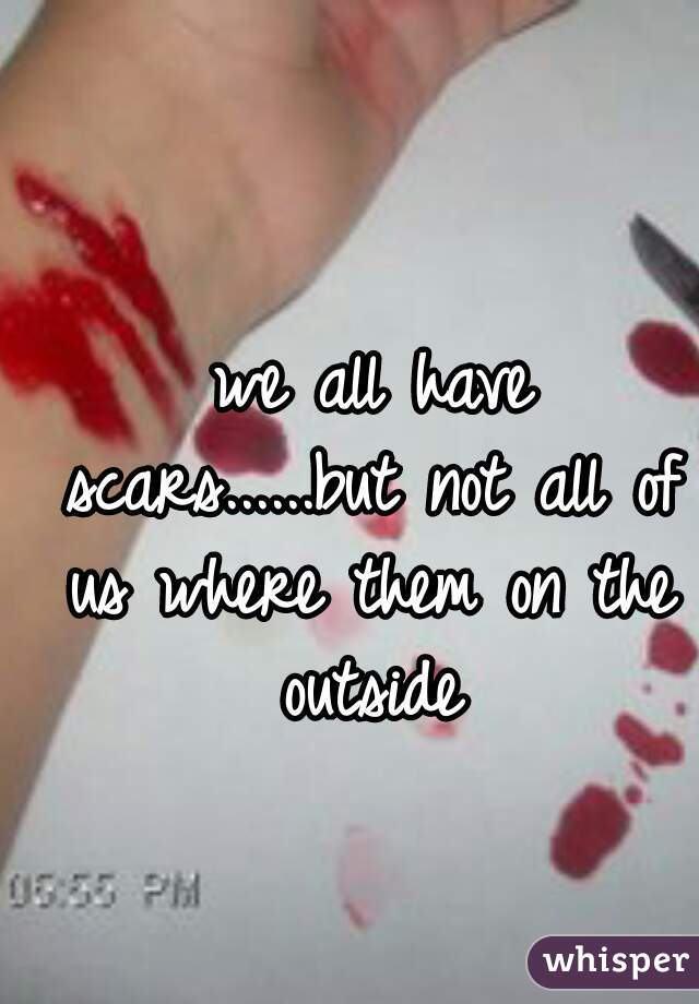  we all have scars......but not all of us where them on the outside
