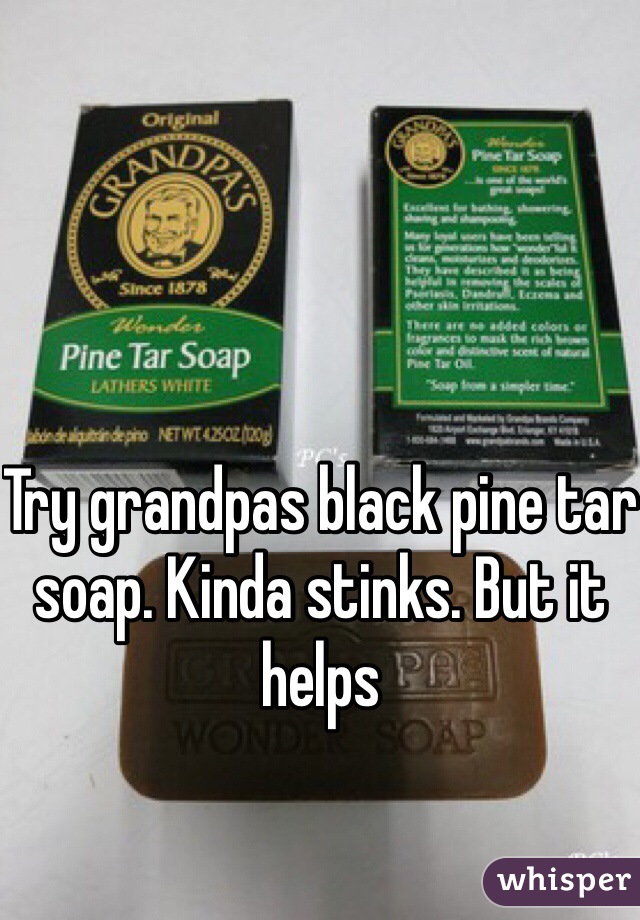 Try grandpas black pine tar soap. Kinda stinks. But it helps