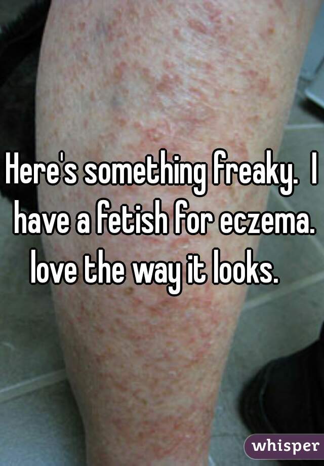 Here's something freaky.  I have a fetish for eczema. love the way it looks.   