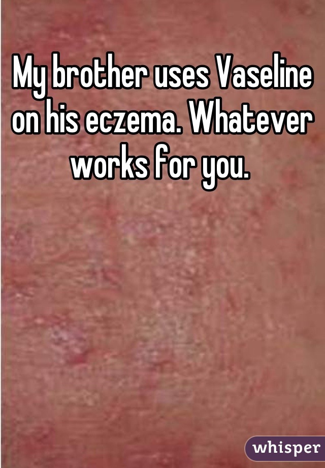 My brother uses Vaseline on his eczema. Whatever works for you. 
