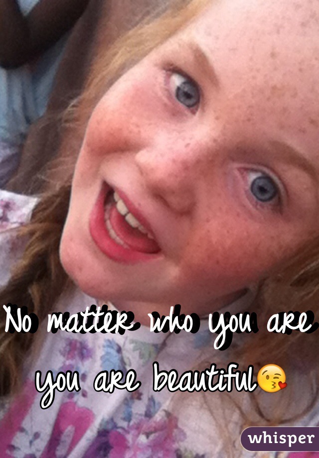 No matter who you are you are beautiful😘