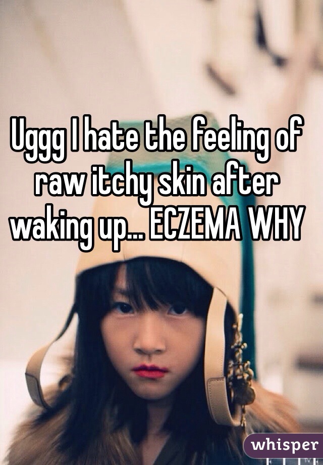 Uggg I hate the feeling of raw itchy skin after waking up... ECZEMA WHY