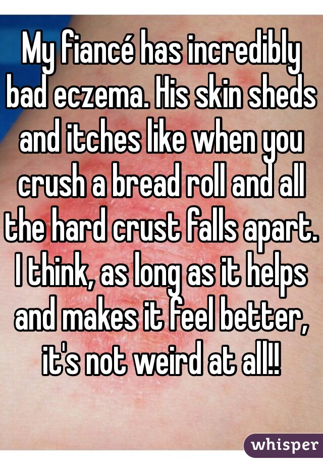My fiancé has incredibly bad eczema. His skin sheds and itches like when you crush a bread roll and all the hard crust falls apart. 
I think, as long as it helps and makes it feel better, it's not weird at all!!