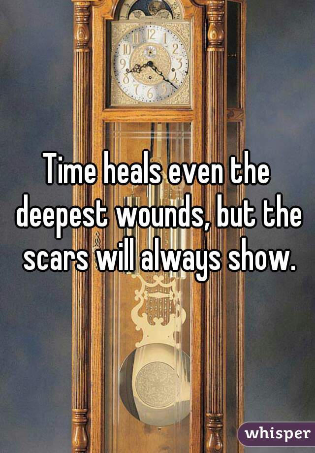 Time heals even the deepest wounds, but the scars will always show.