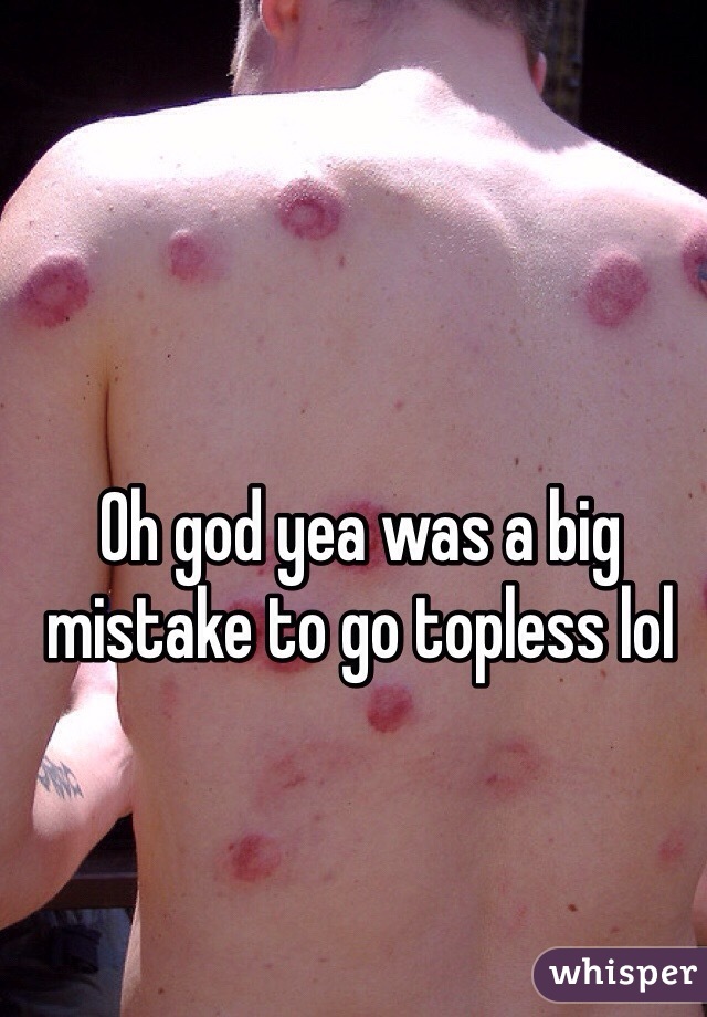 Oh god yea was a big mistake to go topless lol