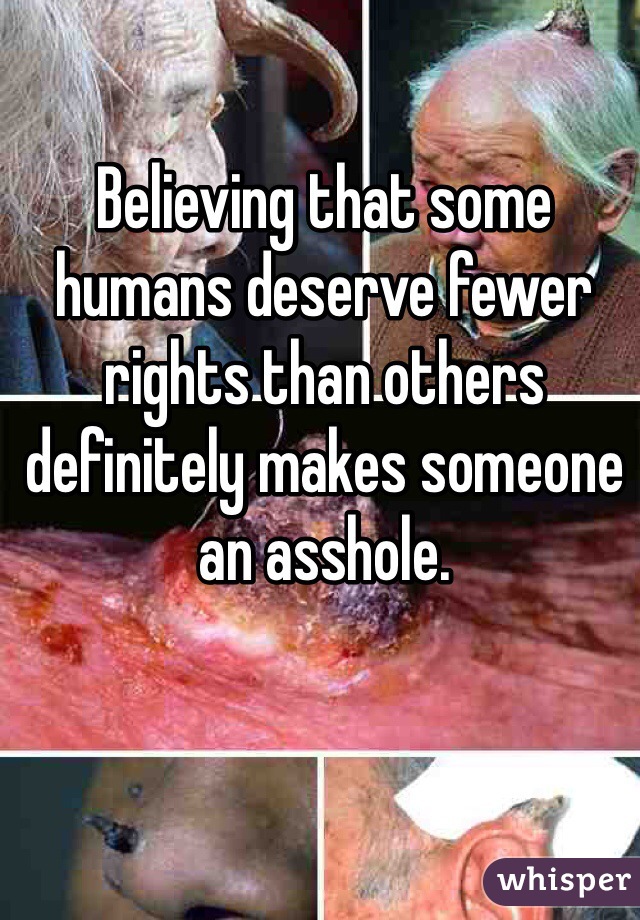 Believing that some humans deserve fewer rights than others definitely makes someone an asshole.