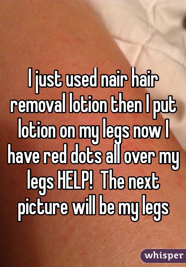 I just used nair hair removal lotion then I put lotion on my legs now I have red dots all over my legs HELP!  The next picture will be my legs
