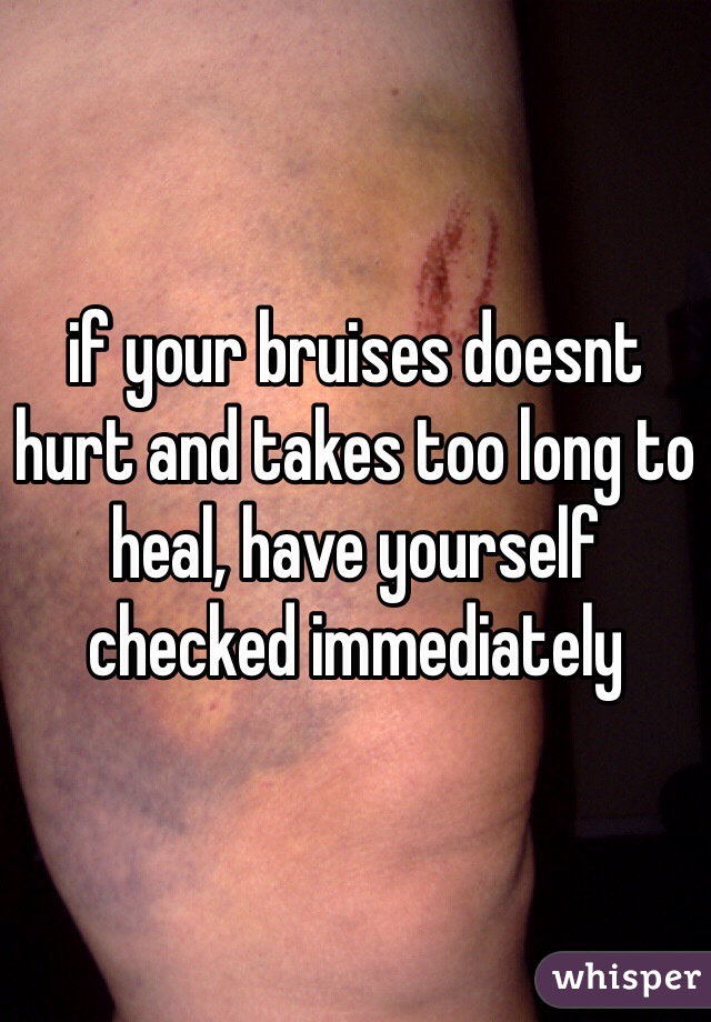 if your bruises doesnt hurt and takes too long to heal, have yourself checked immediately