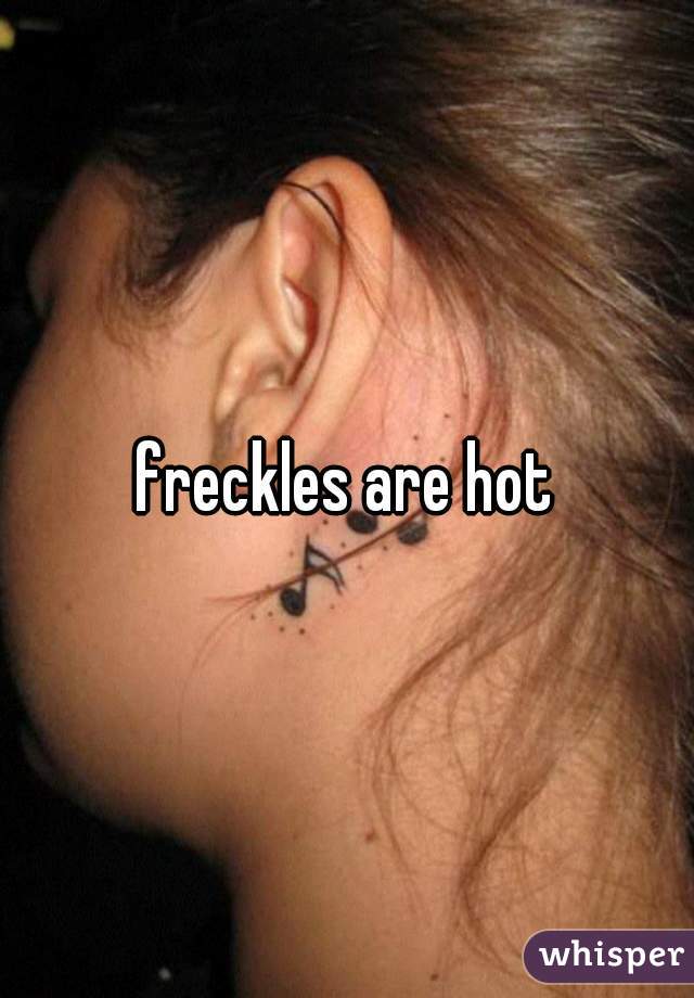 freckles are hot