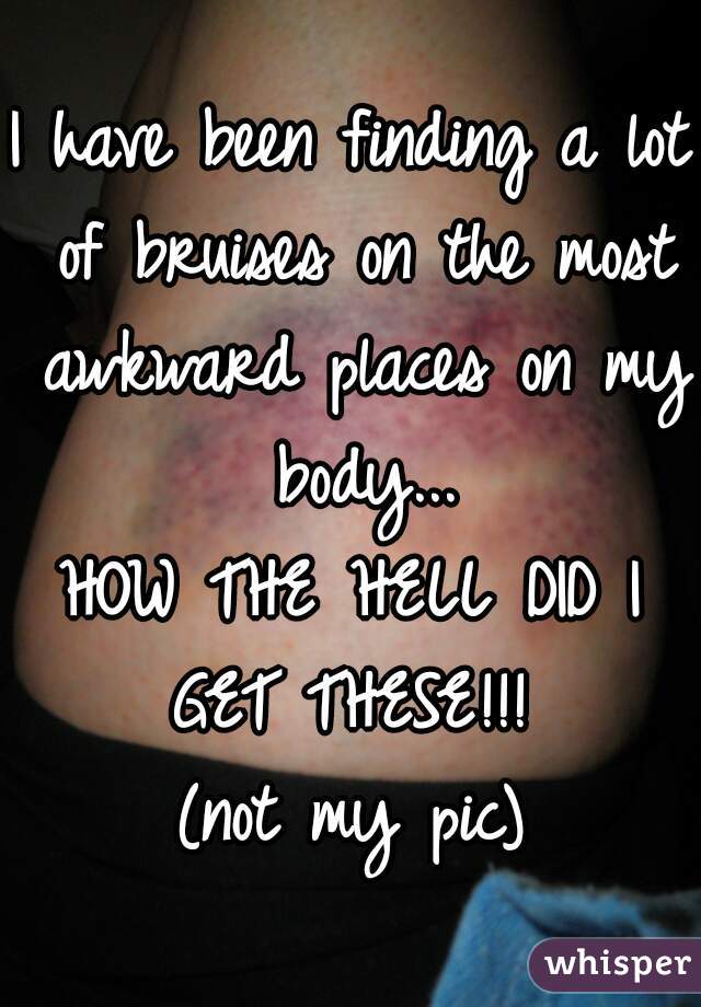 I have been finding a lot of bruises on the most awkward places on my body...

HOW THE HELL DID I GET THESE!!! 

(not my pic)