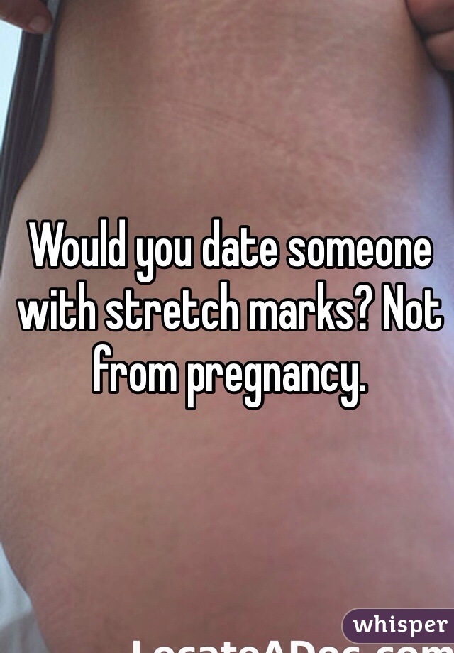 Would you date someone with stretch marks? Not from pregnancy.