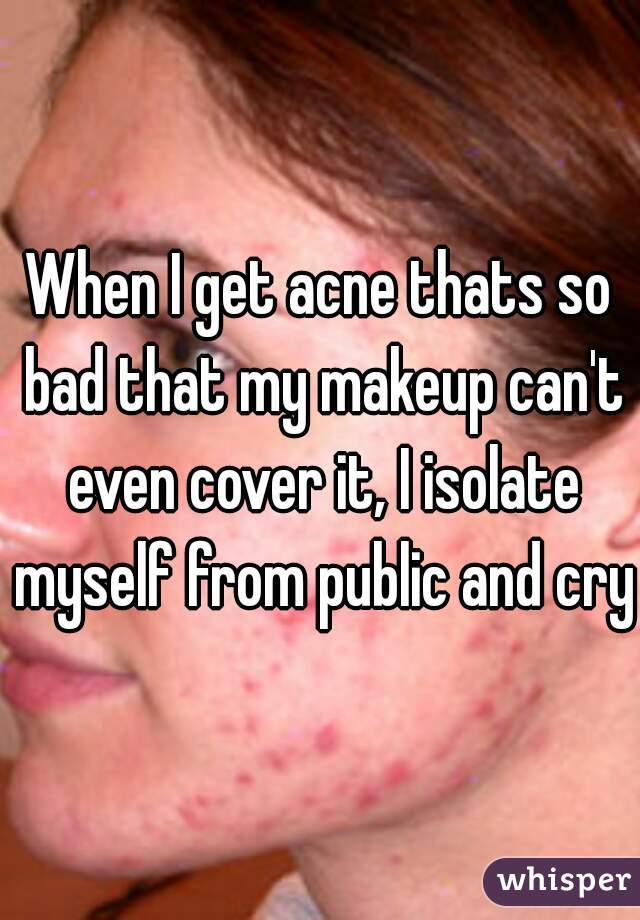 When I get acne thats so bad that my makeup can't even cover it, I isolate myself from public and cry.
