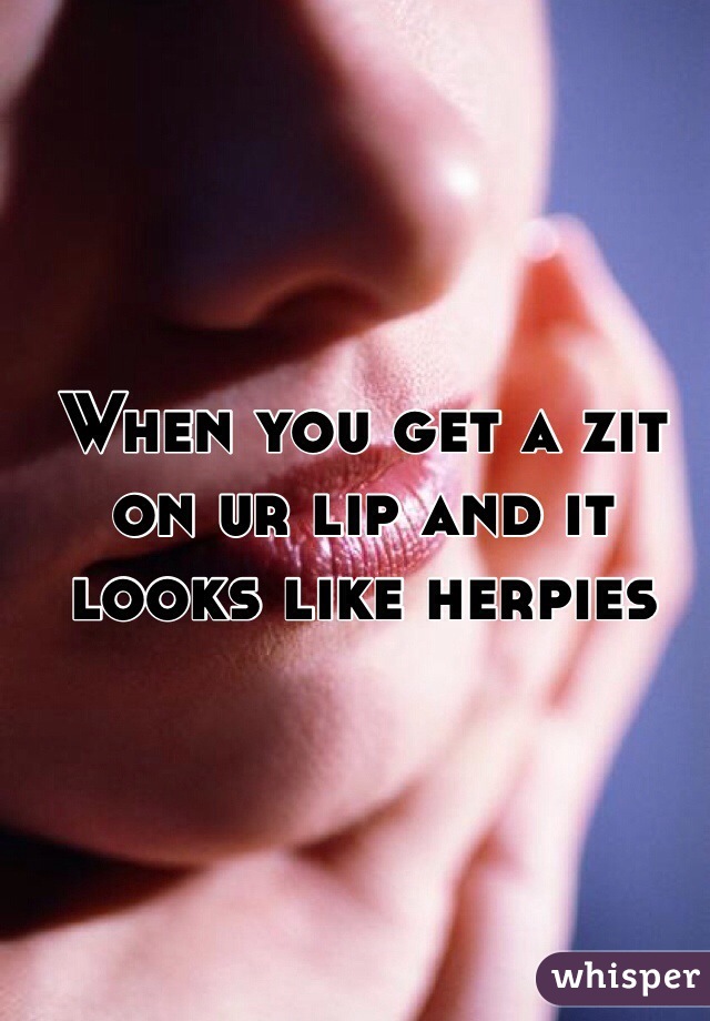 When you get a zit on ur lip and it looks like herpies