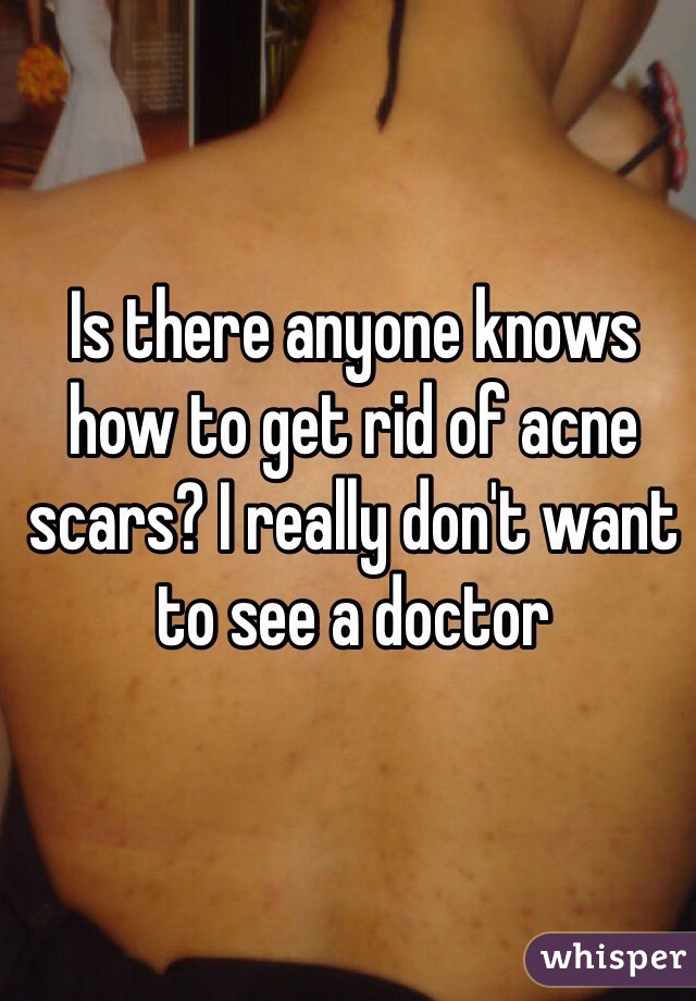 Is there anyone knows how to get rid of acne scars? I really don't want to see a doctor
