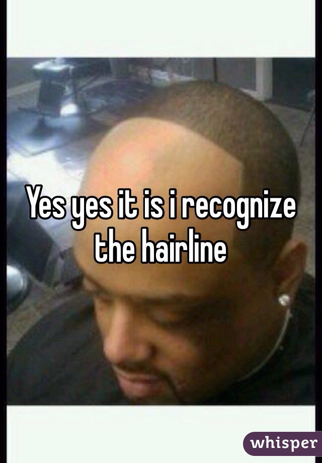 Yes yes it is i recognize the hairline