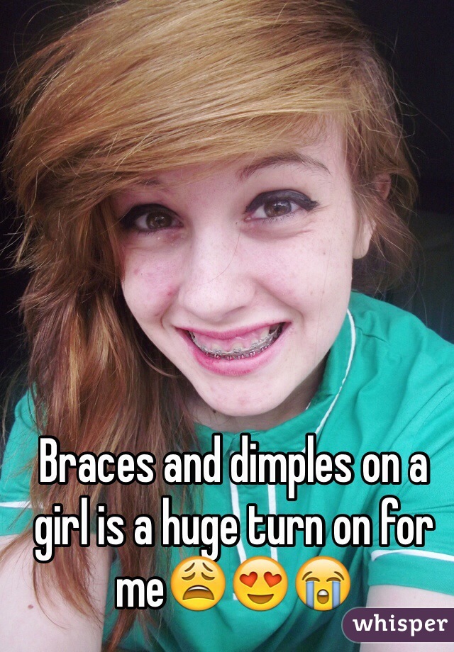 Braces and dimples on a girl is a huge turn on for me😩😍😭